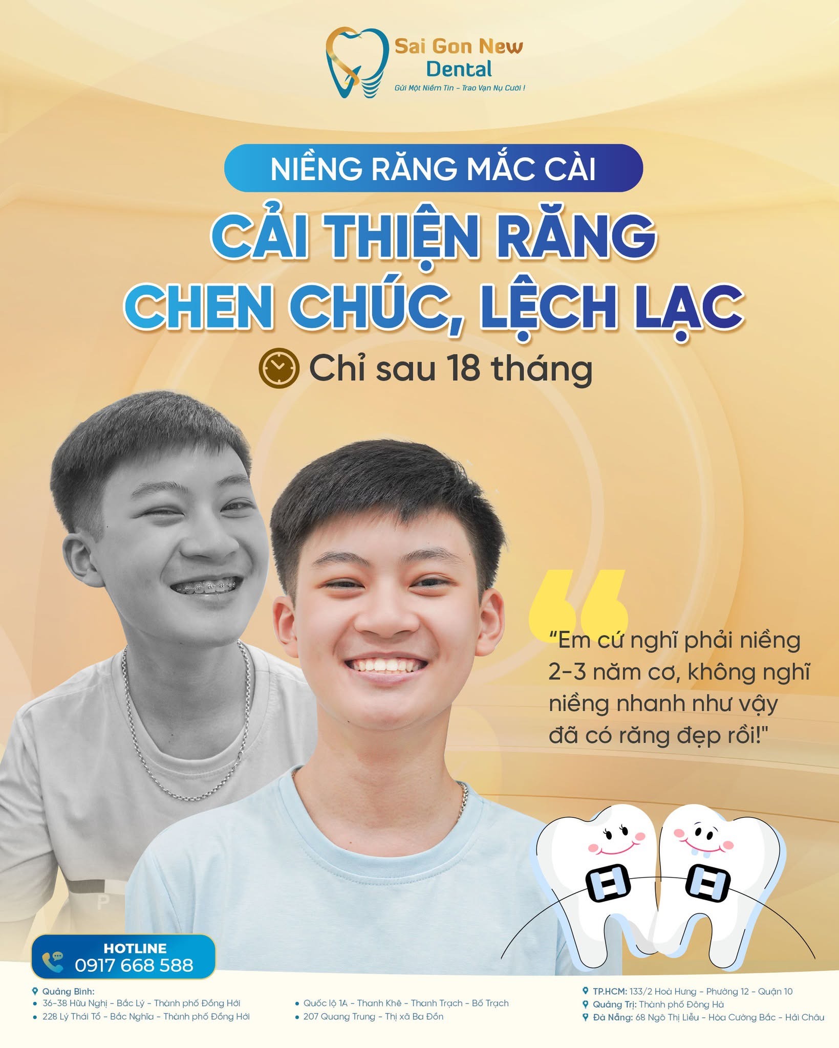 Niềng răng có giúp cải thiện sức khỏe răng miệng không?