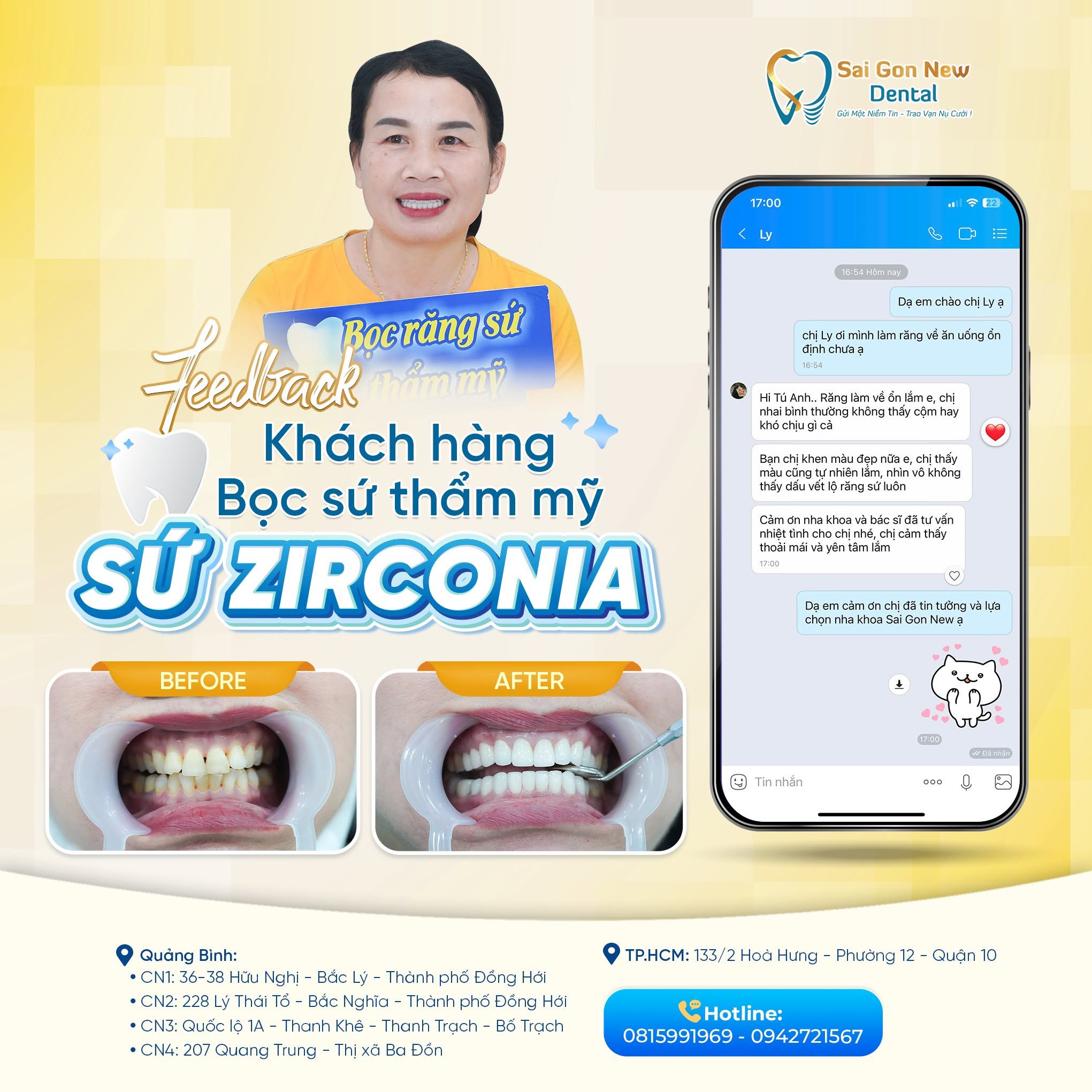 Bọc răng sứ tại nha khoa Sai Gon New Dental.