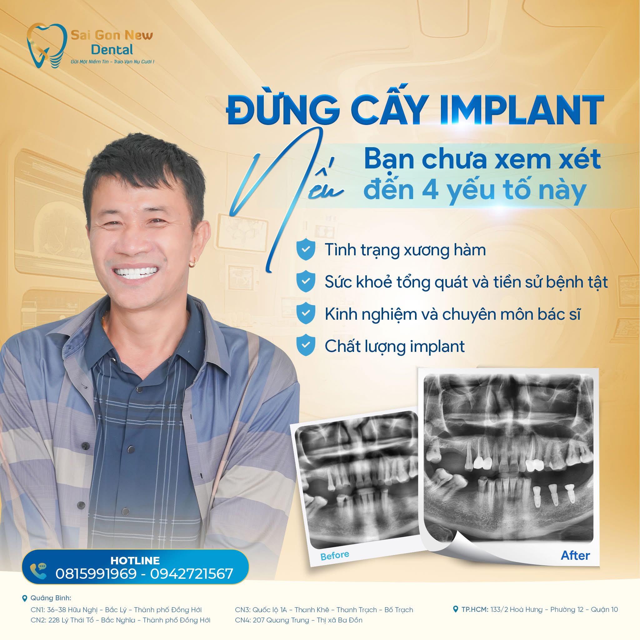 Trồng răng Implant có đau không?