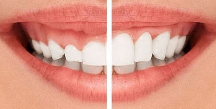 Bảng giá dịch vụ tại nha khoa Sai Gon New Dental.