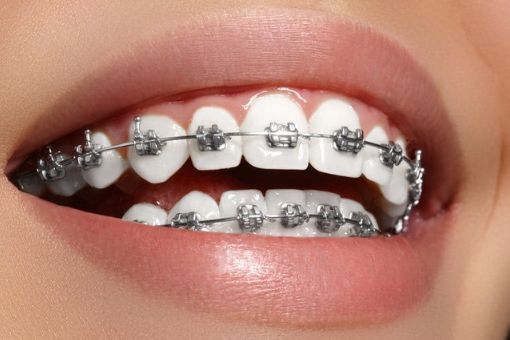 Bảng giá của dịch vụ nha khoa Sai Gon New Dental.