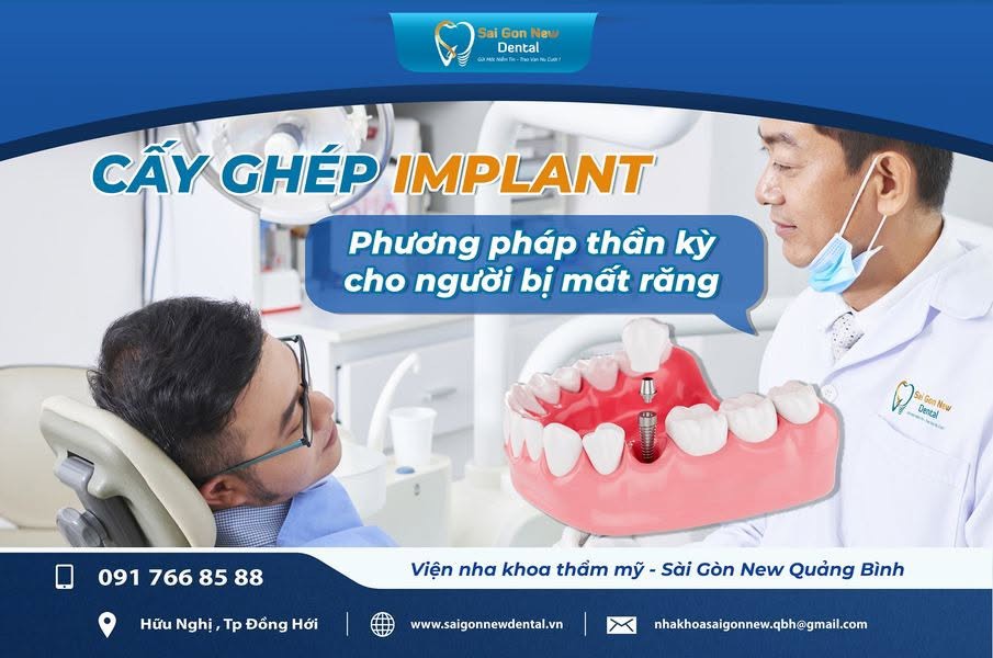 Những đối tượng khách hàng nào nên trồng răng implant?