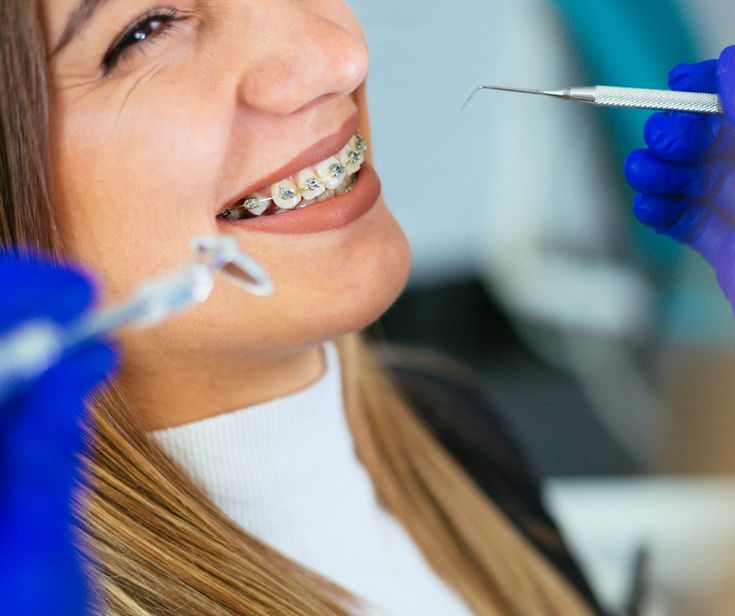 Lợi ích khi lựa chọn dịch vụ niềng răng tại nha khoa Sai Gon New Dental?