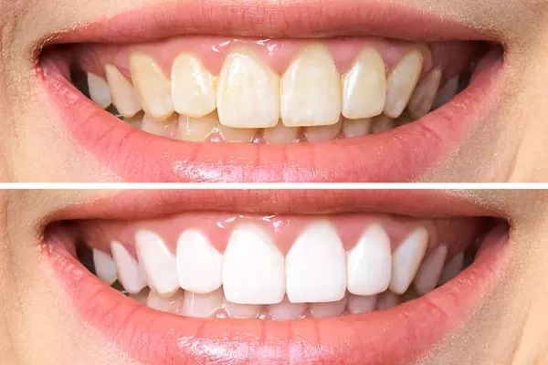 Vì sao nên chọn làm dịch vụ tại nha khoa Sai Gon New Dental?