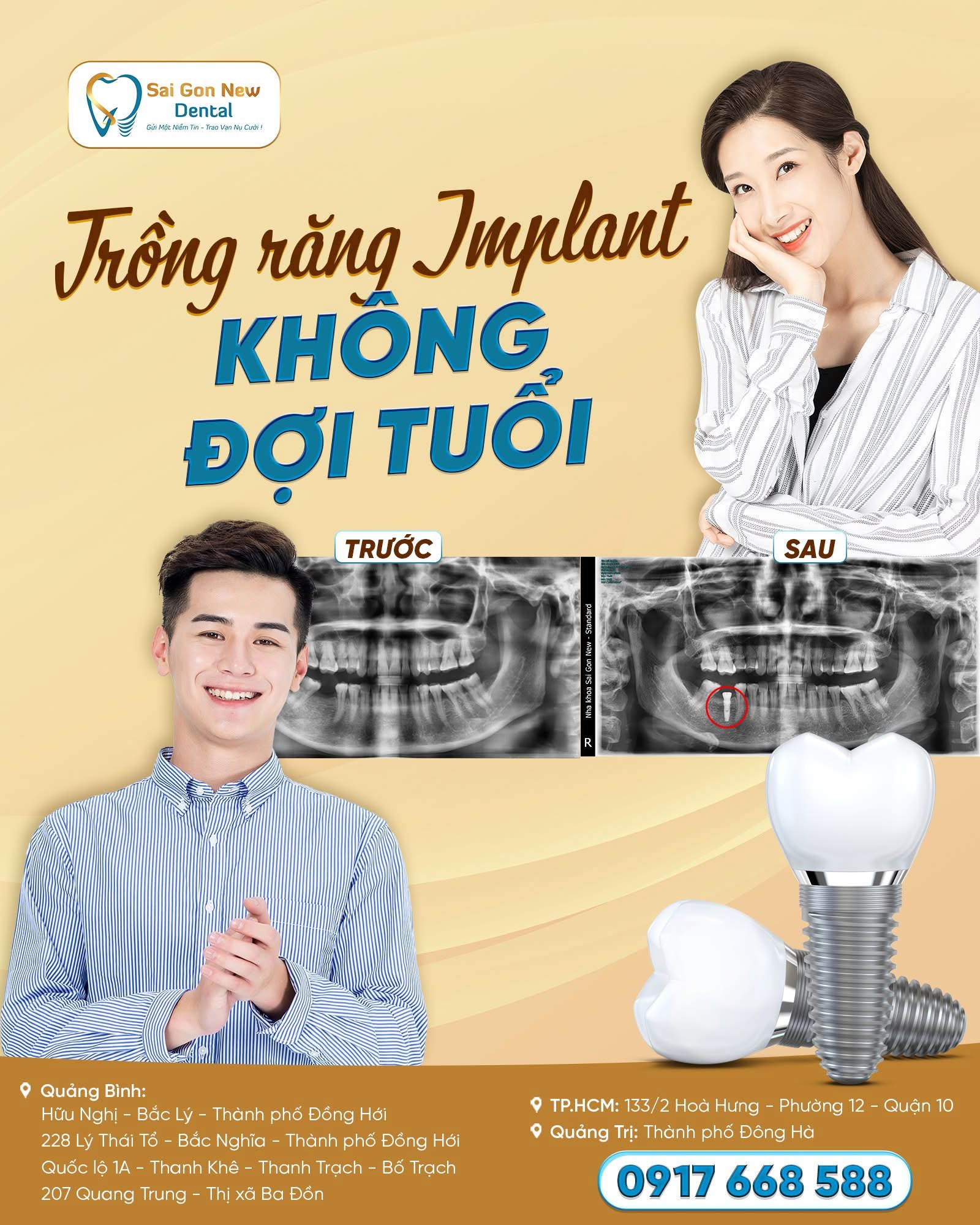 Dịch vụ trồng răng implant đang phổ biến 2025.