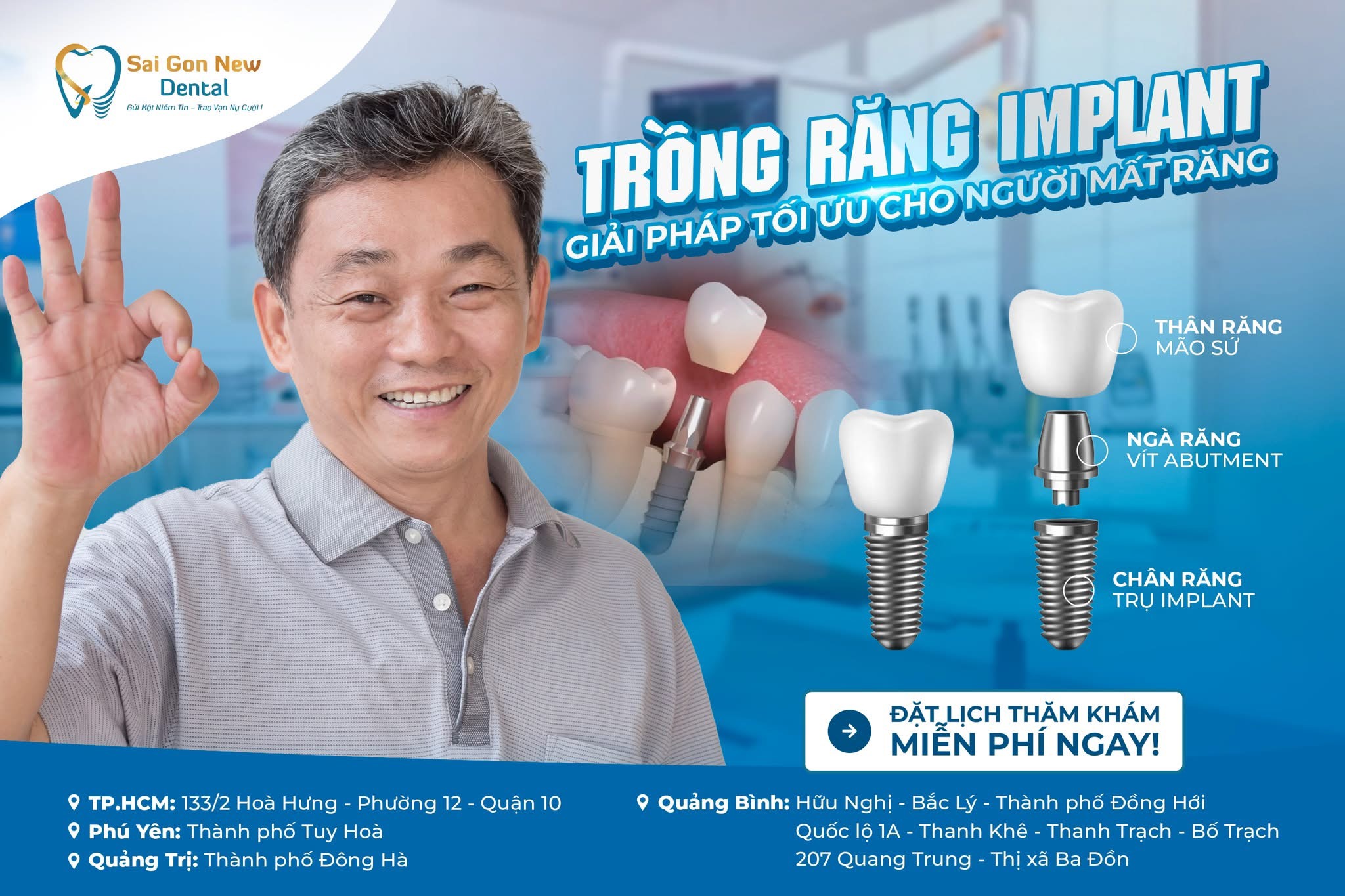 Tại sao trồng răng Implant lại được xem là giải pháp vượt trội trong phục hình răng hiện đại?