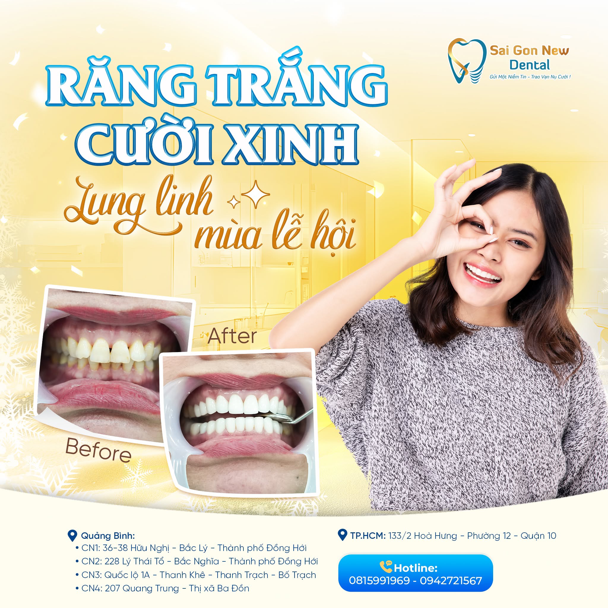 Ưu điểm khi lựa chọn dịch vụ bọc răng sứ giá rẻ.