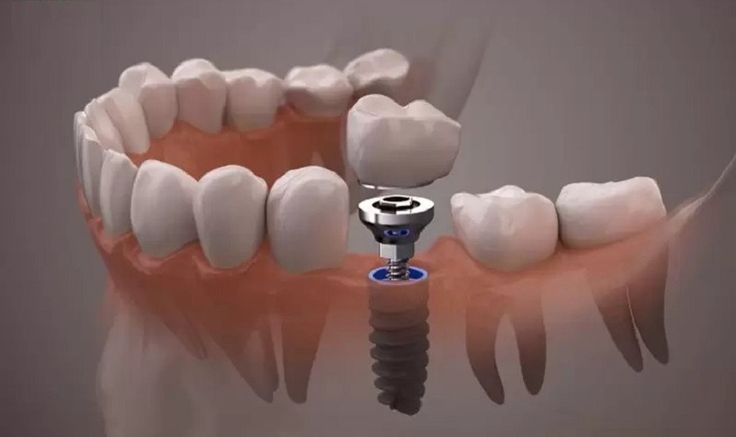 Vì sao khách hàng nên chọn dịch vụ làm răng tại nha khoa Sai Gon New Dental?