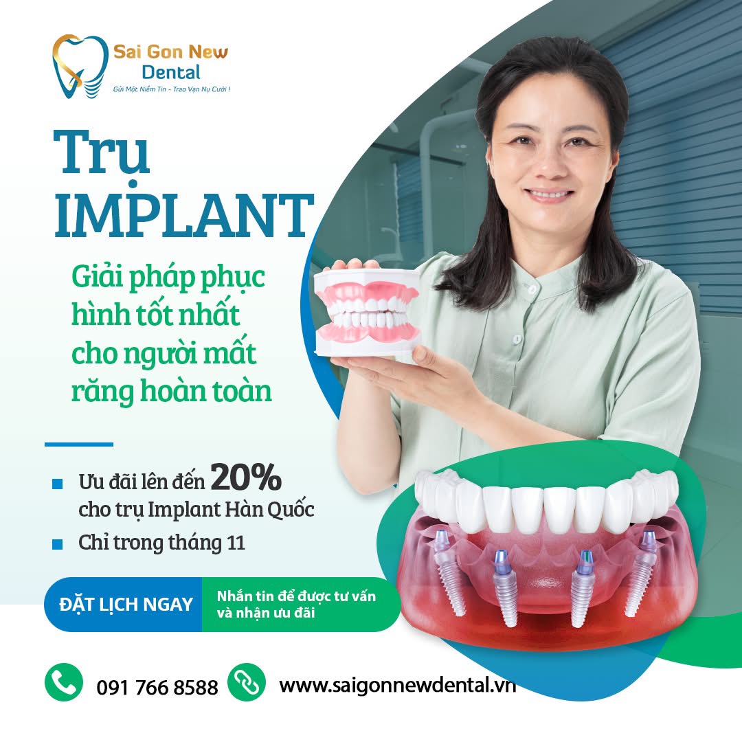 Những lợi ích khi sử dụng dịch vụ cấy ghép răng implant.