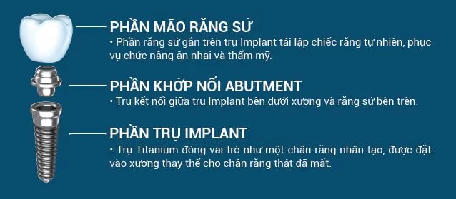 Cấy ghép răng trụ implant là gì?