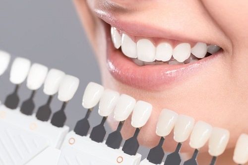 Những dịch vụ phổ biến tại nha khoa Sai Gon New Dental.