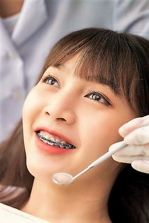 Dịch vụ niềng răng cho người lớn tại Sai Gon New Dental.