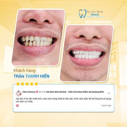 Các dịch vụ tại Nha khoa Sài Gòn New Dental