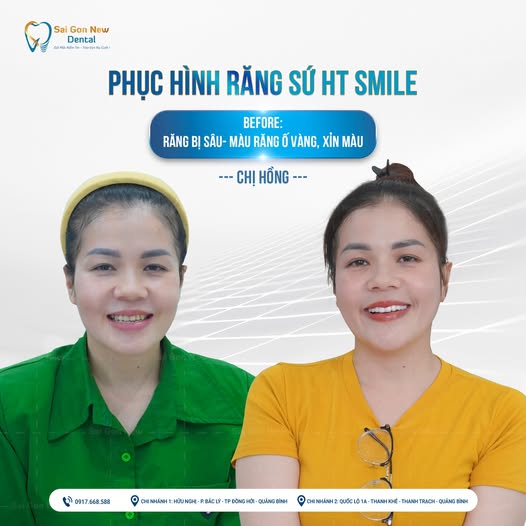 Phục hình răng