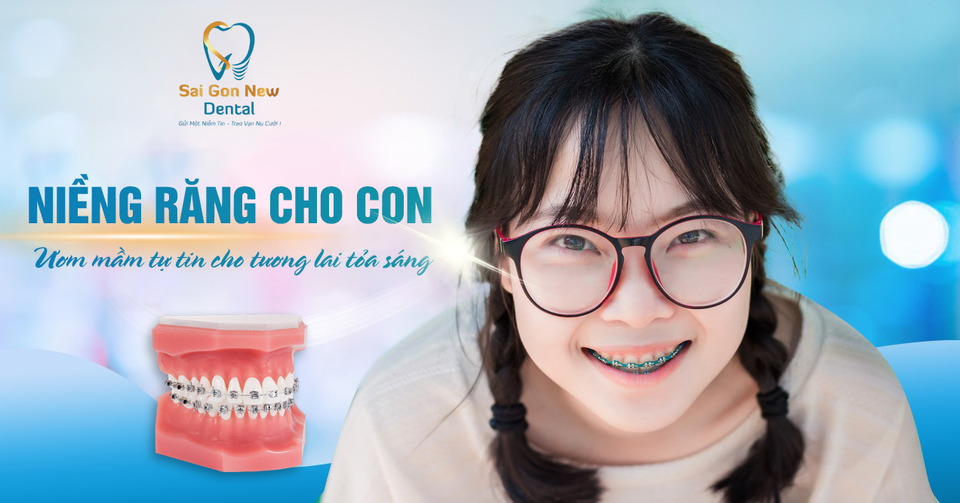 Niềng răng chỉnh nha giá bao nhiêu? Bảng giá mới nhất 2024