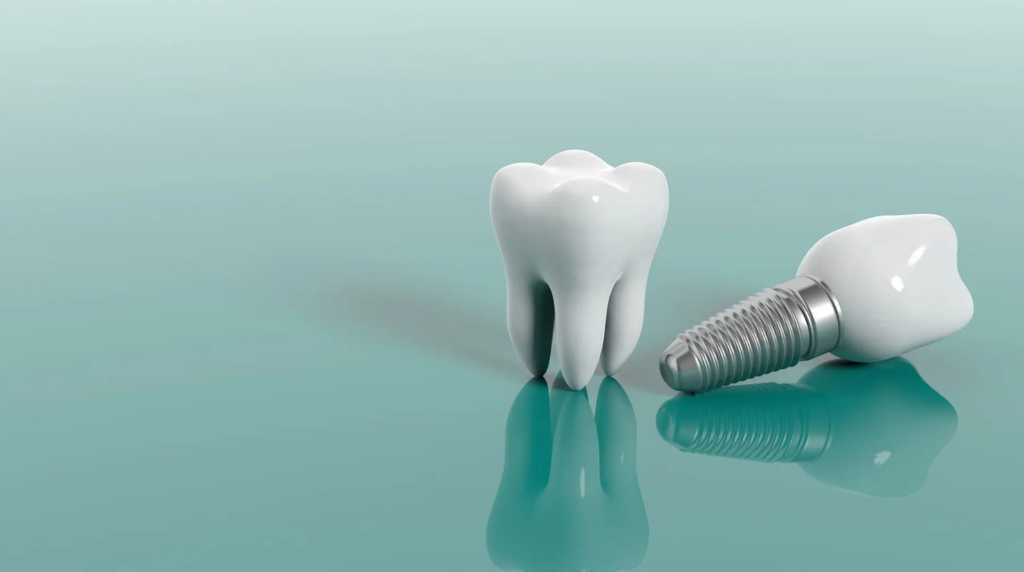 Cấy ghép răng implant tại nha khoa Sai Gon New Dental giá bao nhiêu tiền?